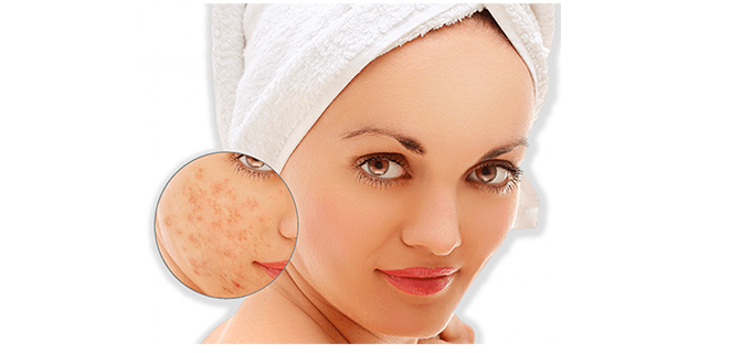 التهاب الجلد بسبب مستحضرات التجميل