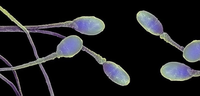 تراص الحيوانات المنوية