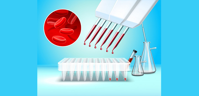 نقص المناعة الثانوي