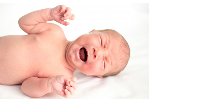 سوء الدوران المعوي الولادي