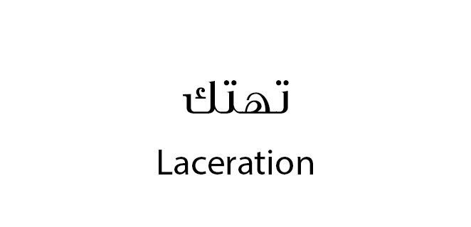 تهتك