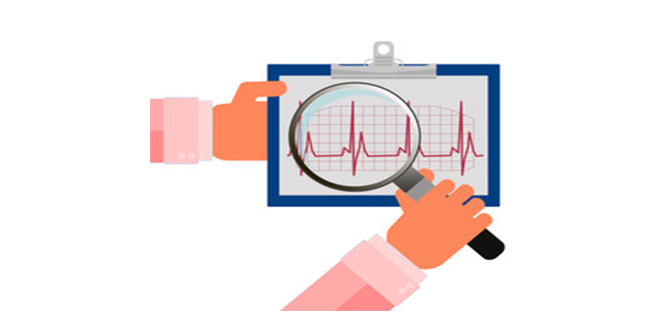 رفرفة اذينية