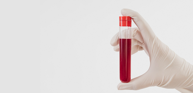 محلول اسوي التوتر