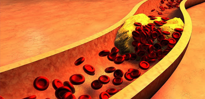 بروتين شحمي منخفض الكثافة