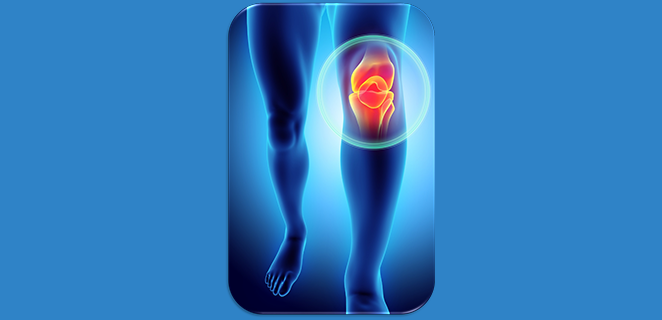 التهاب العظم والغضروف