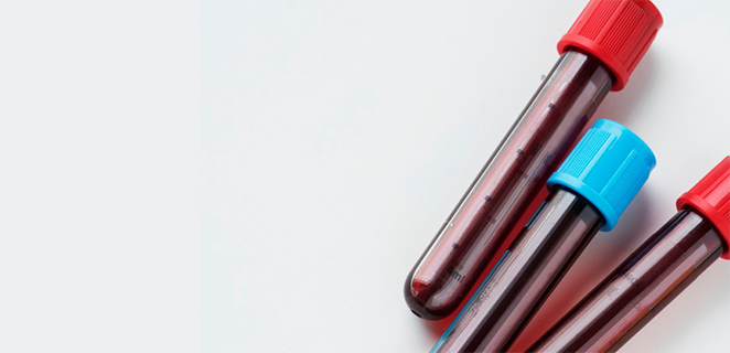 مبحث الامصال