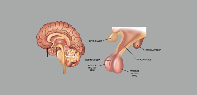 ورم غدي نخامي