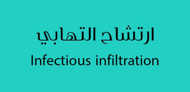 ارتشاح التهابي