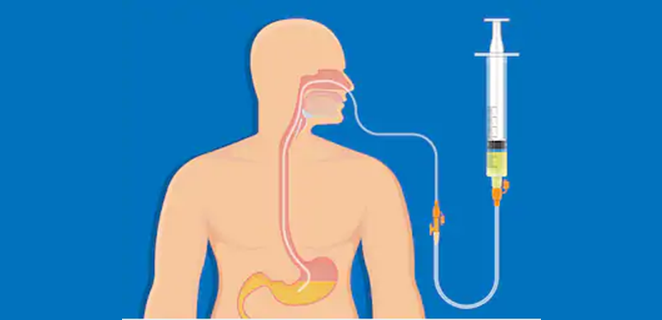 تغذية معوية