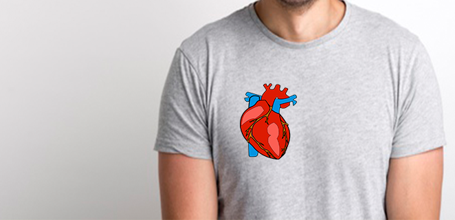 متلازمة كارتاغينر