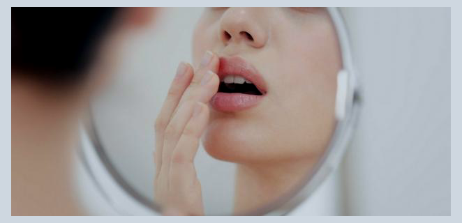 التهاب الشفة