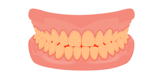 احمرار الاسنان
