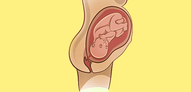 وضعية قذالية خلفية