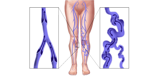 معالجة بالتصليب