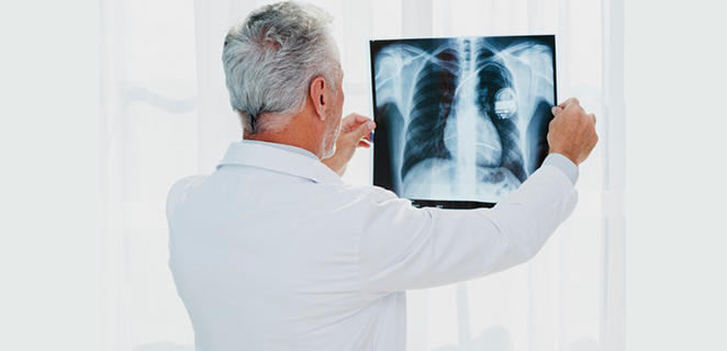 اختصاصي بالسل