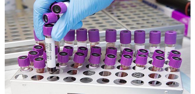 فحص الهرمونات