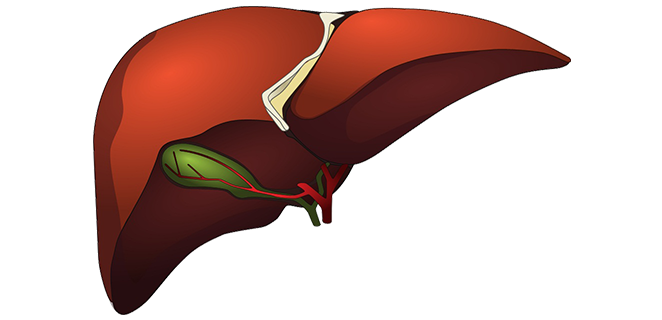 تحصي صفراوي