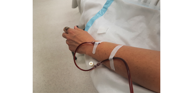 معالجة مصلية