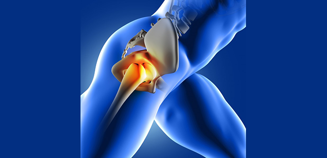 التهاب الزليل العابر