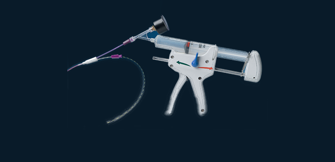 تنظير الرحم