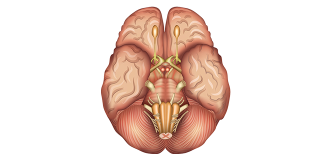 احصار البطينات