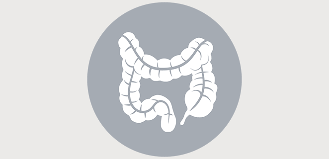 فغر القولون وتثبيته