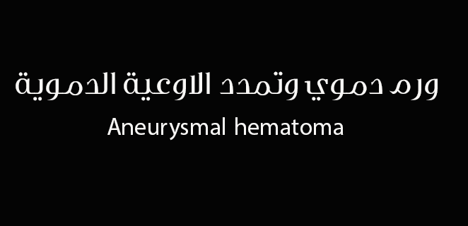 ورم دموي وتمدد الاوعية الدموية أ م د م كاذ ب ة اسباب الطبي