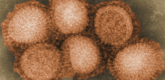 انفلونزا اسبانية