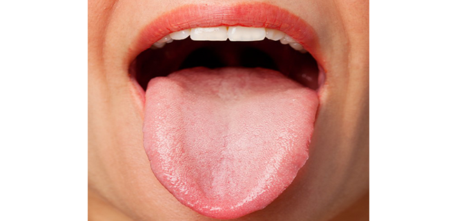 وجود السكر في اللعاب