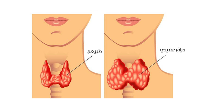 دراق عقيدي سام