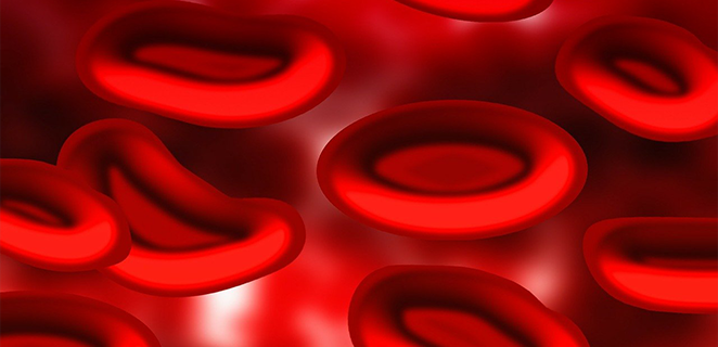 اضطرابات نزفية