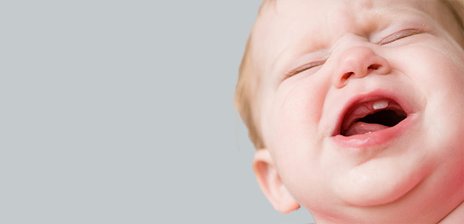 تسنين الفك العلوي