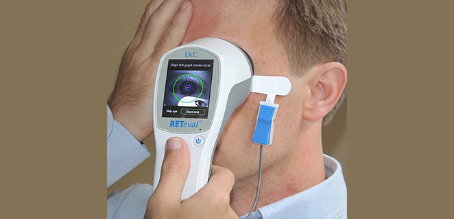 مخطط كهربية الشبكية