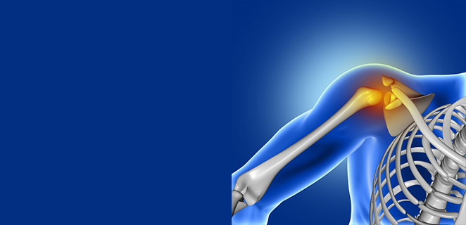 متلازمة التنشب