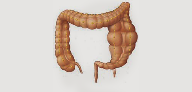 داء هيرشبرنغ