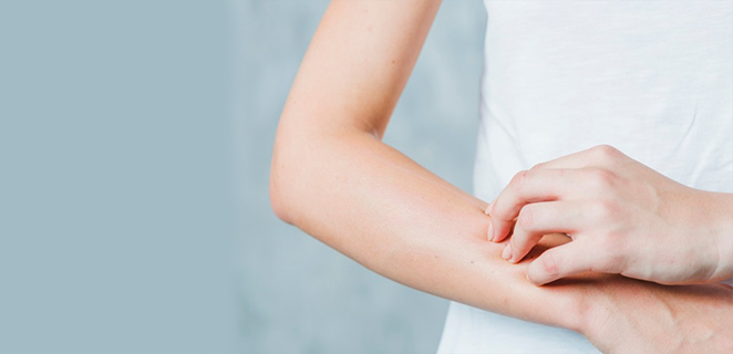 التهاب الجلد التقشري