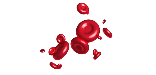 ورم نقوي متعدد