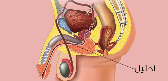 انسداد الاحليل