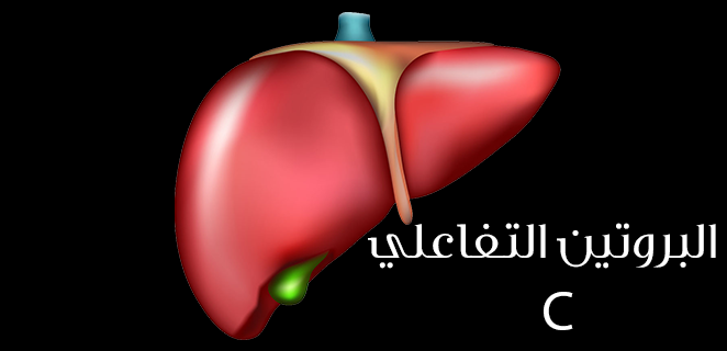 البروتين التفاعلي C