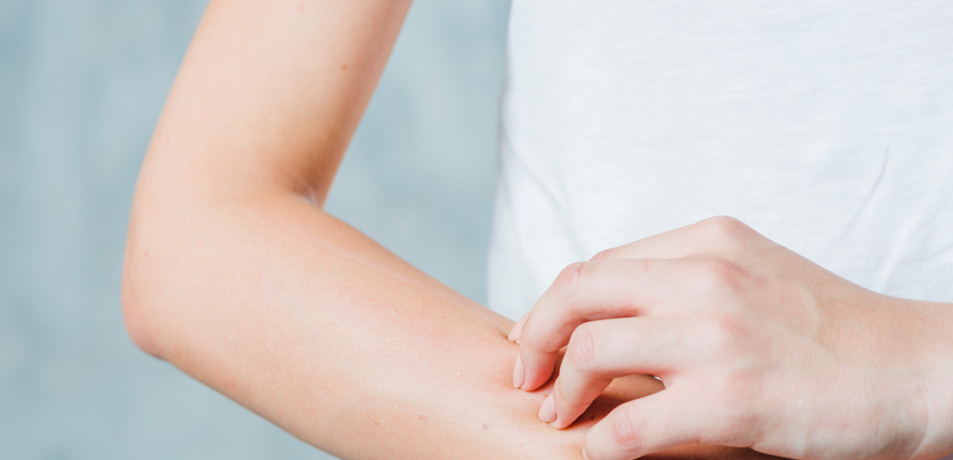 سعفة مبرقشة