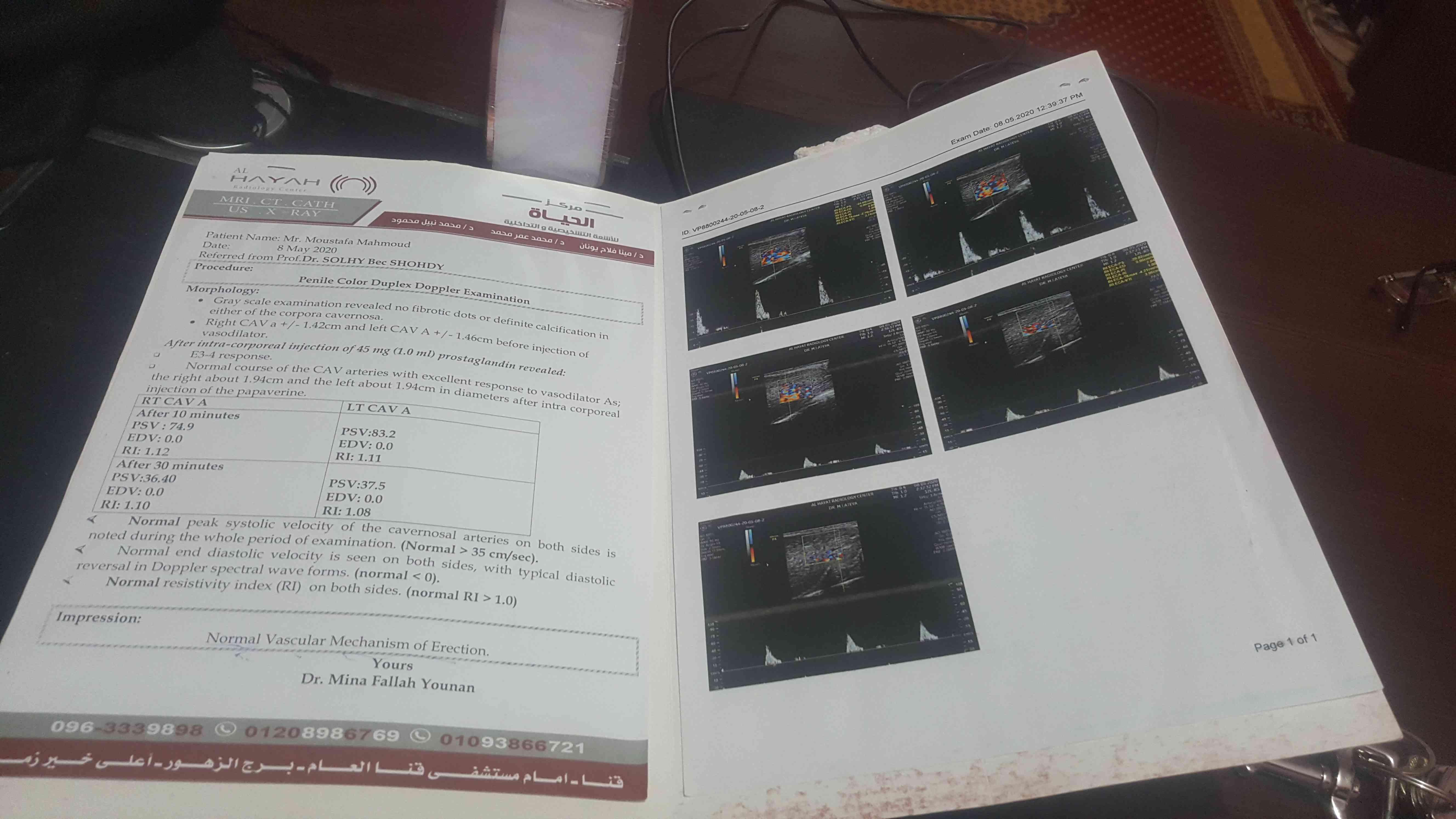 a0787193-dcf2-4e3b-a849-bf50e547cef9