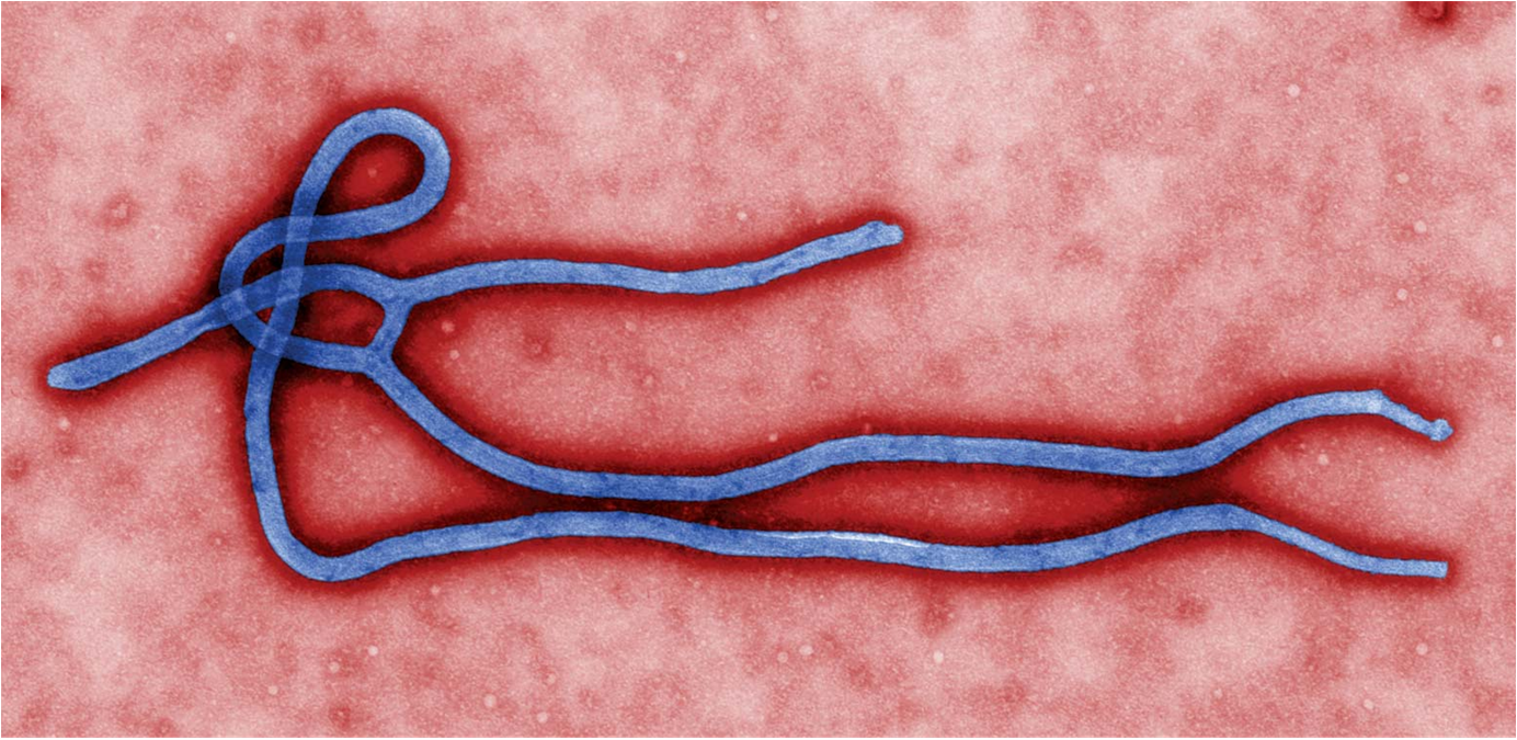 مرض الايبولا