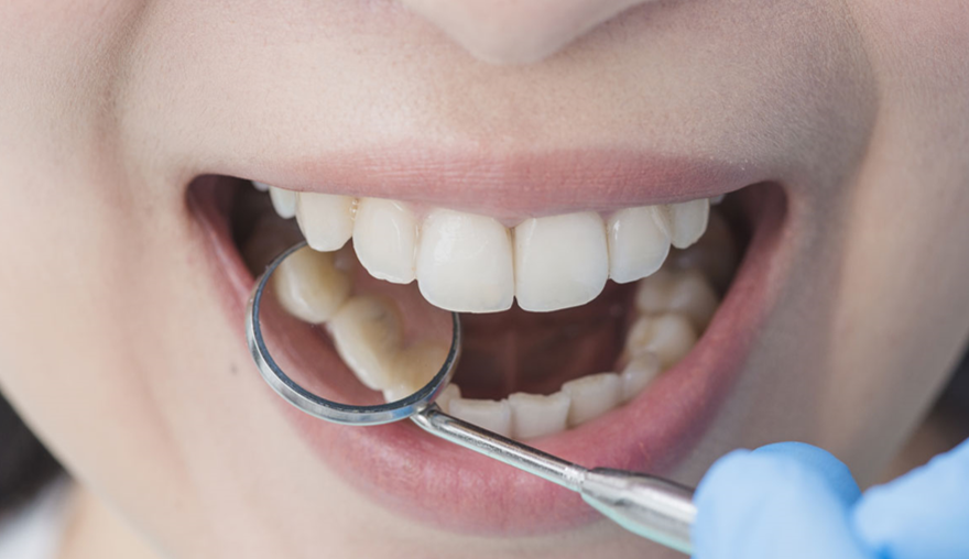 الاسنان صحة الاسنان وكيفية الاعتناء بالاسنان الطبي