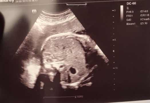 5DADF0BB-111D-4034-B110-A75A39BED8C3