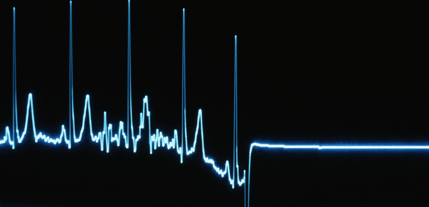 متلازمة لازاروس