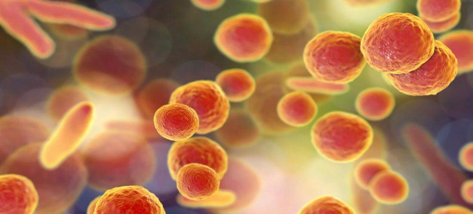 ذات الرئة اللانمطية