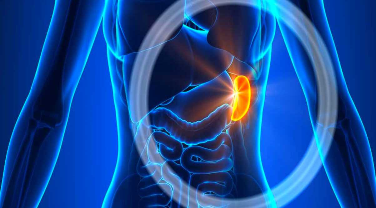 احتشاء طحالي