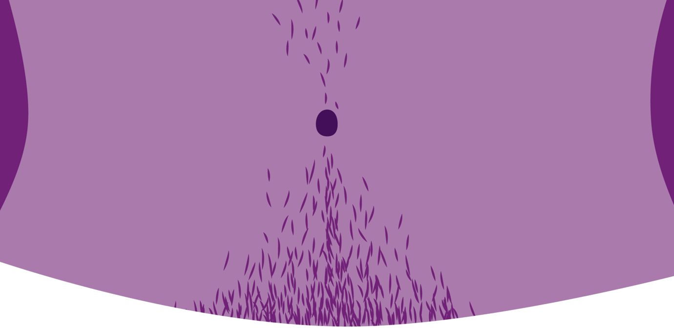 الشعر الزائد غير المرغوب به