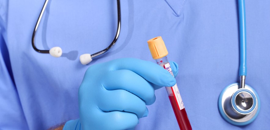 اختبار فيدال