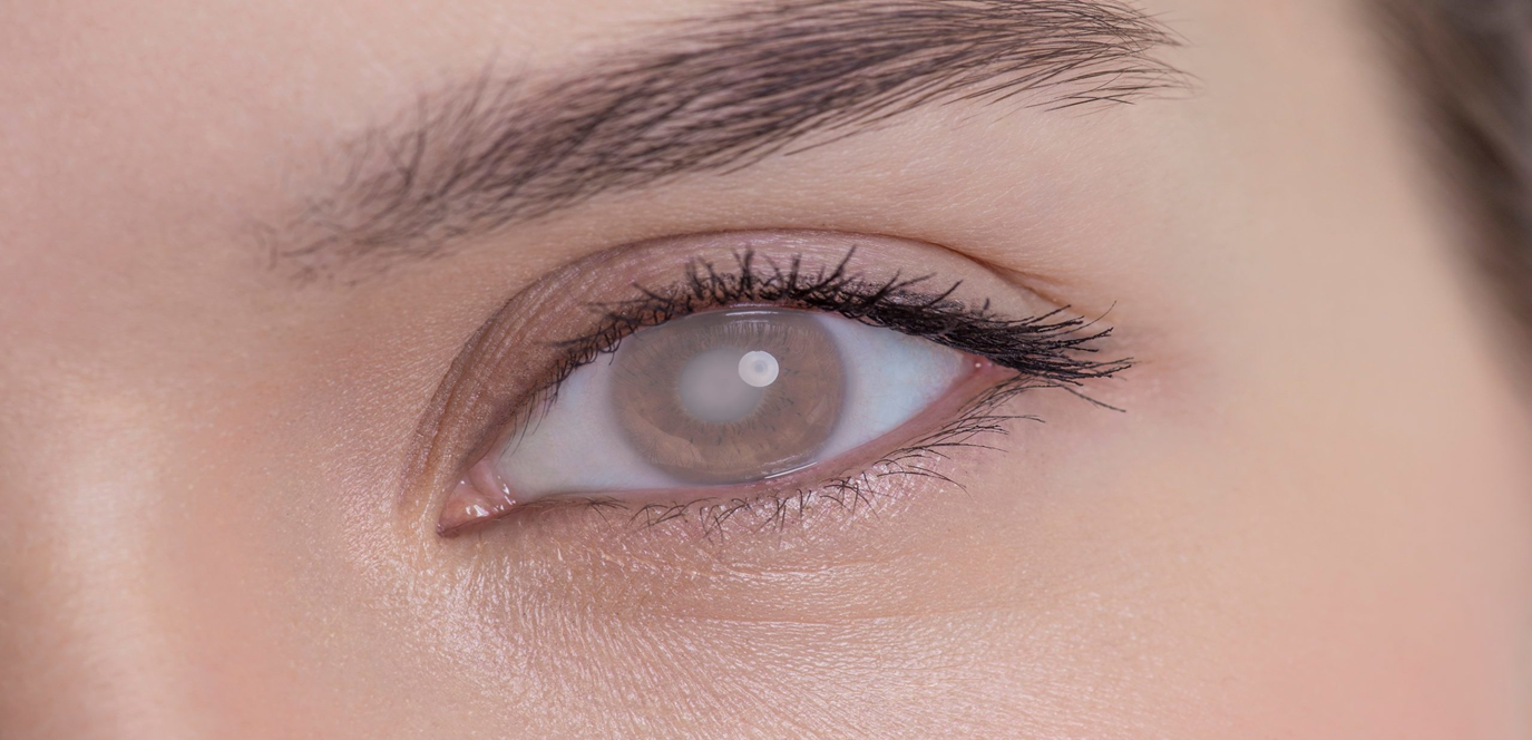 العمى في عين واحدة